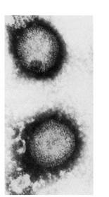 1.Irudia: Mikrobioren baten argazkia.<br>
